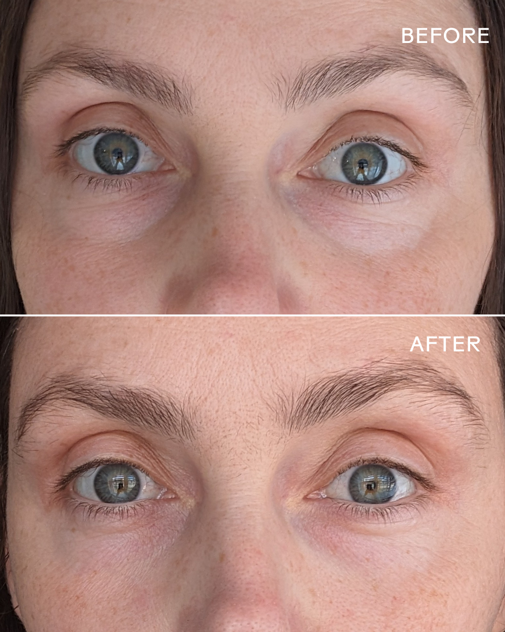 Crème contour des yeux à la vitamine C et à la caféine First Light™